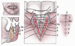 Closing-the-wound-is-painful-300x187