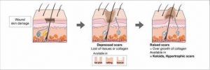 facial-soft-tissue-injury